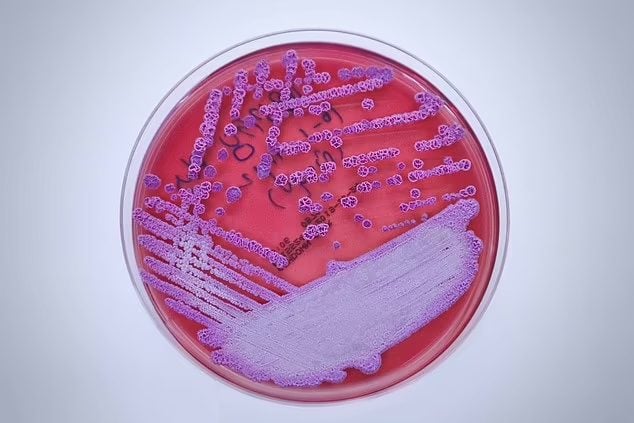 CDC varoittaa tappavista bakteereista, jotka “tappavat jopa 50 prosenttia potilaista”, joita on havaittu Yhdysvaltain Persianlahden rannikolla.