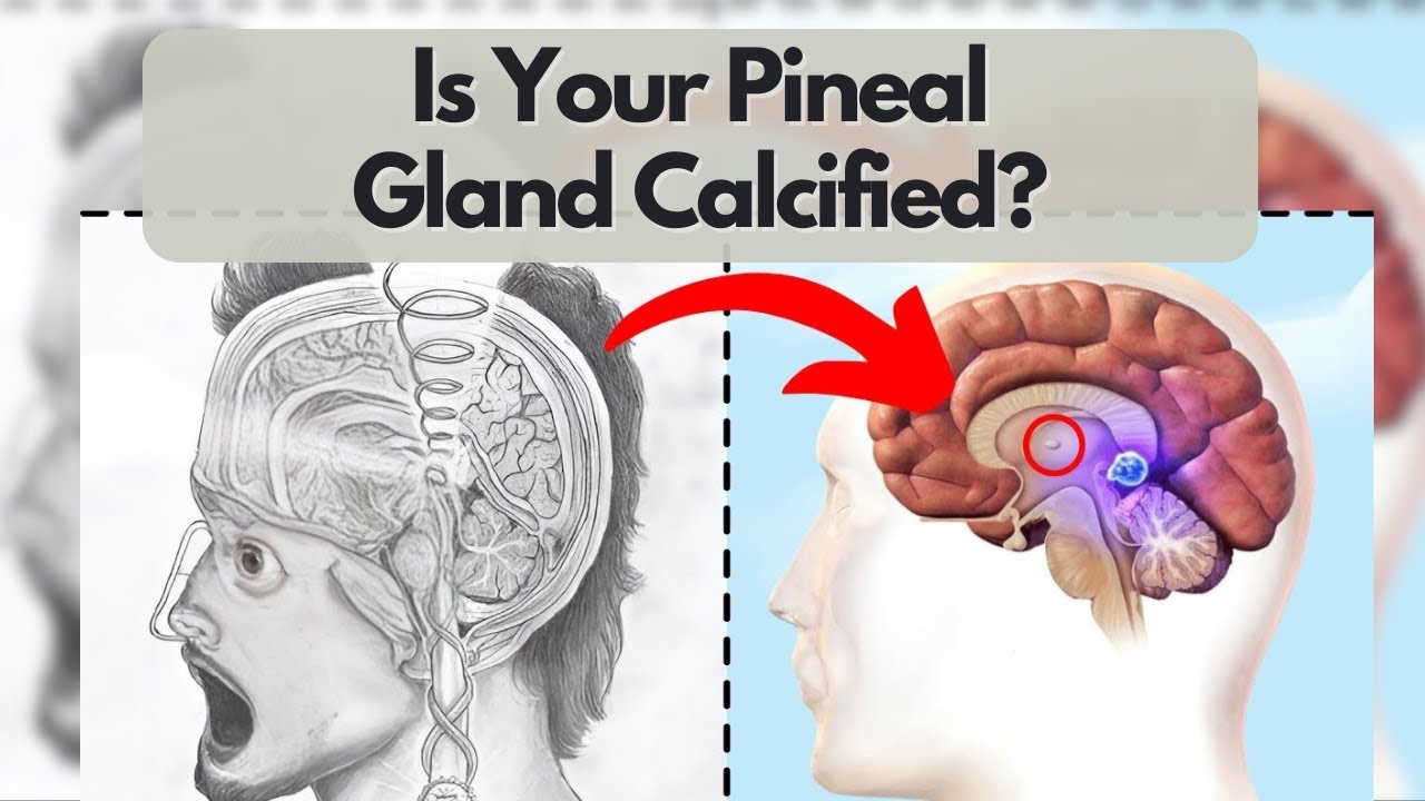 PubXtv: Pineal Gland Decalcification & More